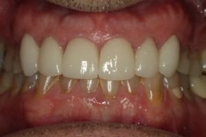 Teeth Repair Smile Gallery