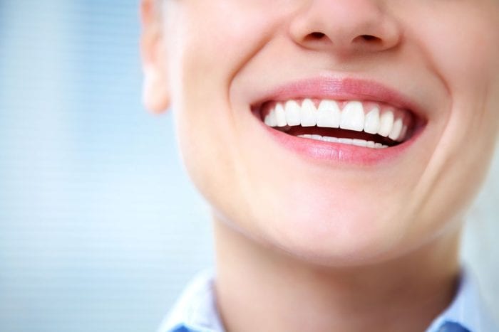 whiten teeth at the dentist in Nashua New Hampshire