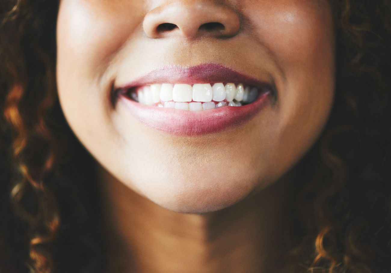 teeth whitening solutions Nashua New Hampshire