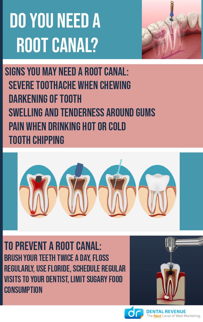 tooth that needs root canal