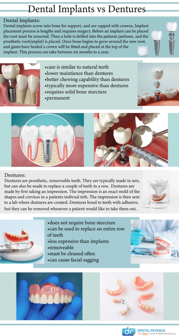 dental implants versus dentures infographic