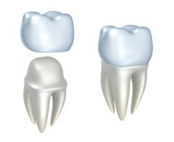 dental crown benefits Nashua New Hampshire