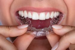 Invisalign aftercare Nashua New Hampshire