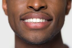 preserve white teeth with preventative dentistry